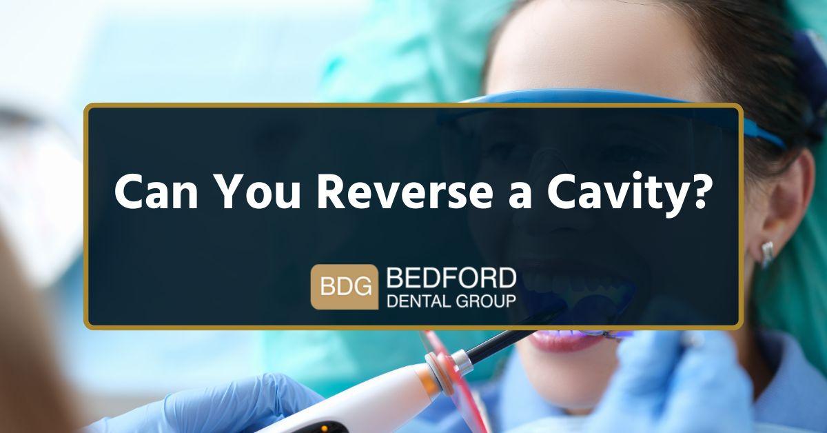 Can you reverse a cavity?