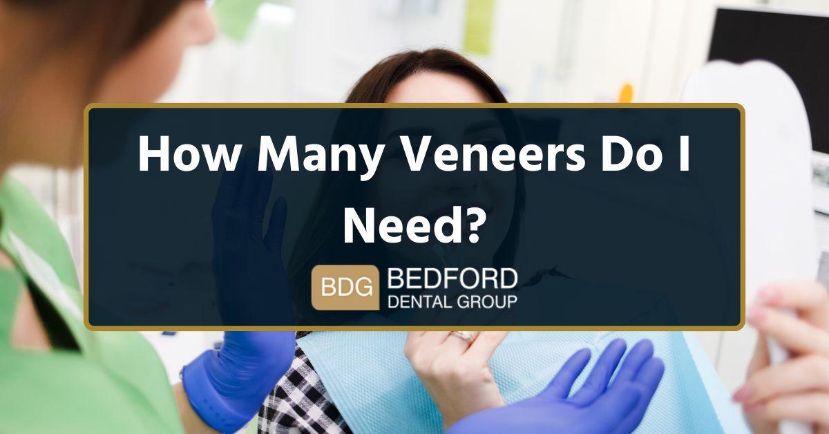 How many veneers do I need?