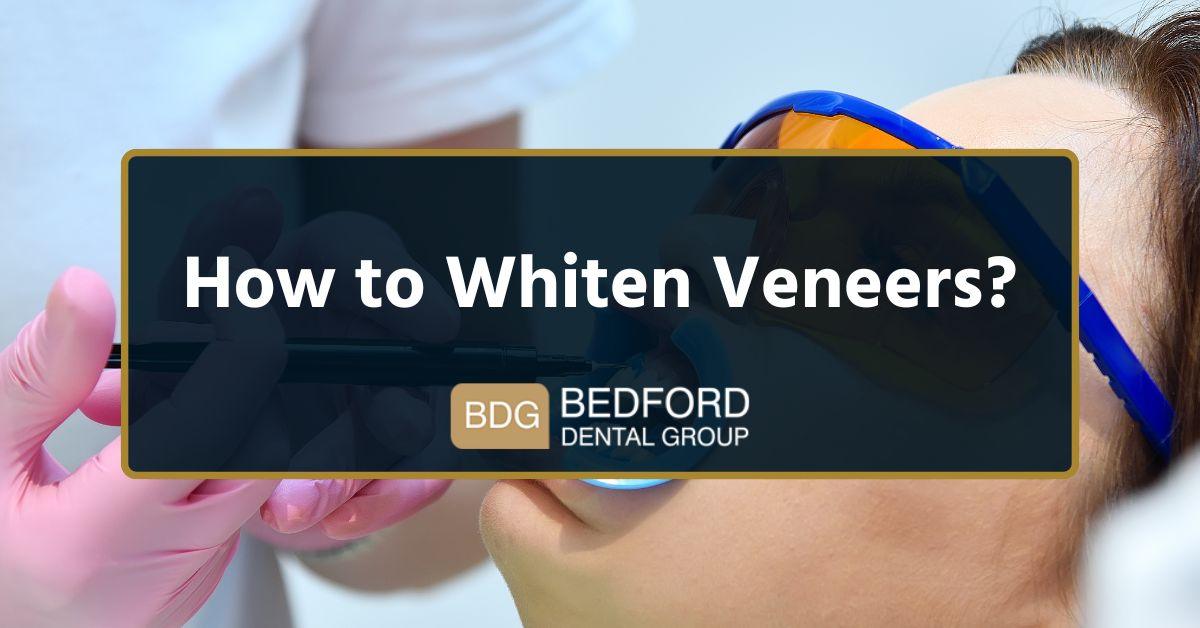 How to whiten veneers?