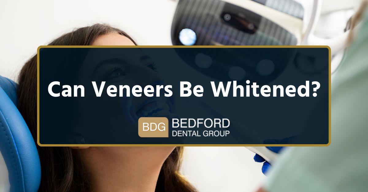 Can veneers be whitened?